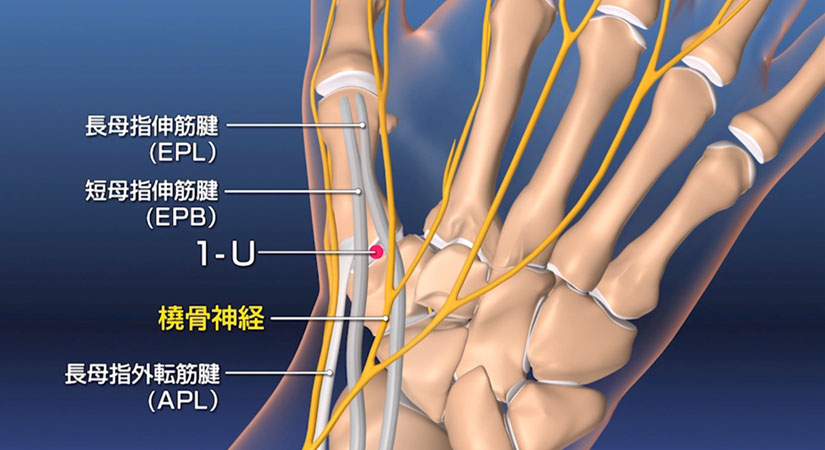 メディカルイラスト